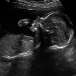 Fundraising Page Image